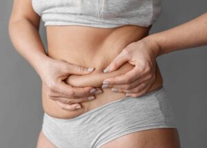 Woman pinching the skin on her abdomen, representing the benefits of liposuction.