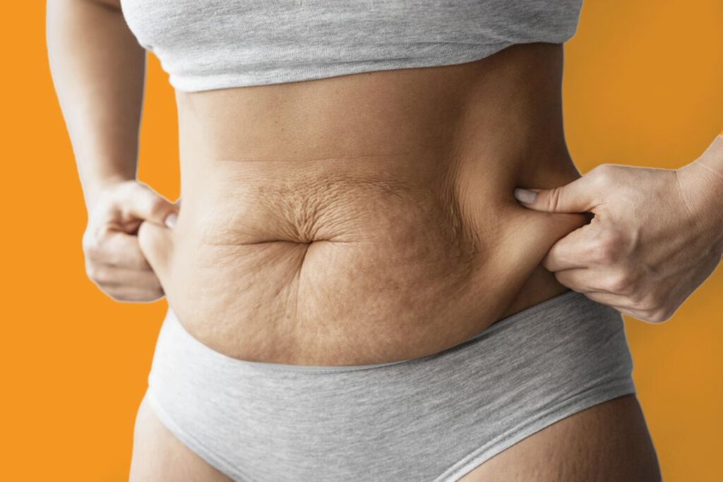 Tummy Tuck vs other abdominal procedures