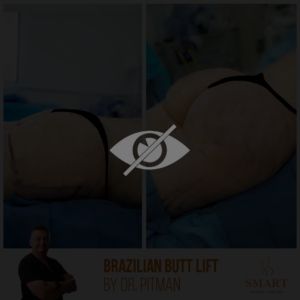 Smart Plastic Surgery: Expert Plastic Surgery in Miami, FL