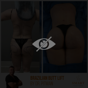 Smart Plastic Surgery: Expert Plastic Surgery in Miami, FL