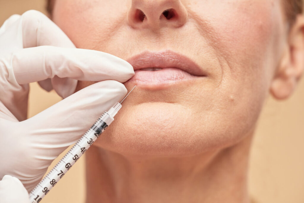 Dermal fillers