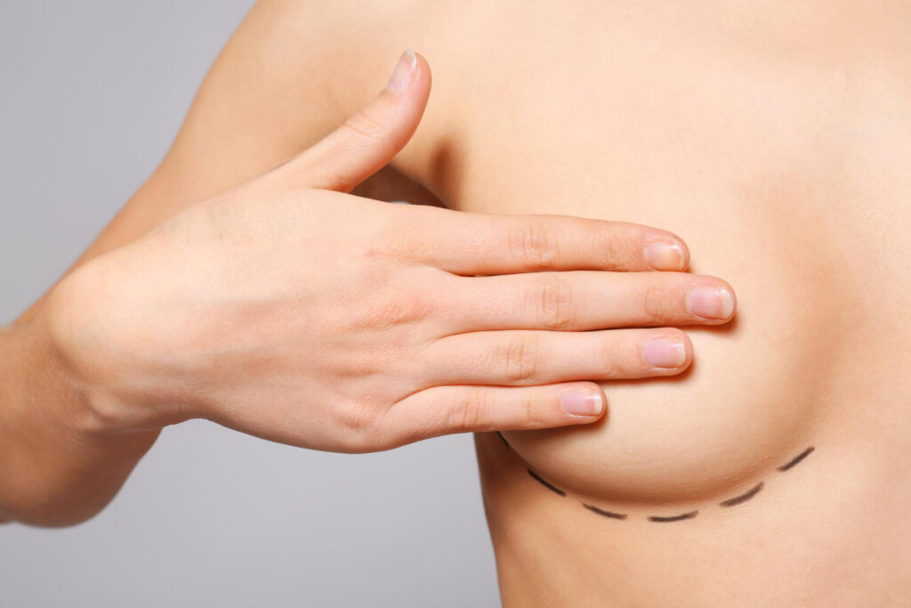 Scarless Breast Lift